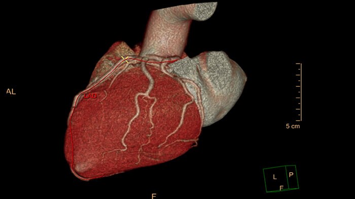 spectral comprehensive cardiac analysis