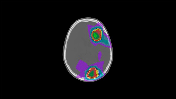 magnetic resonance Therapy HCNMRF143