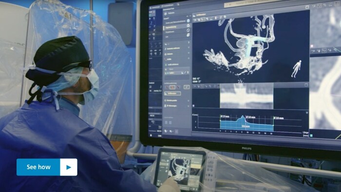 Philips-Neuro-Azurion_Smart_CT