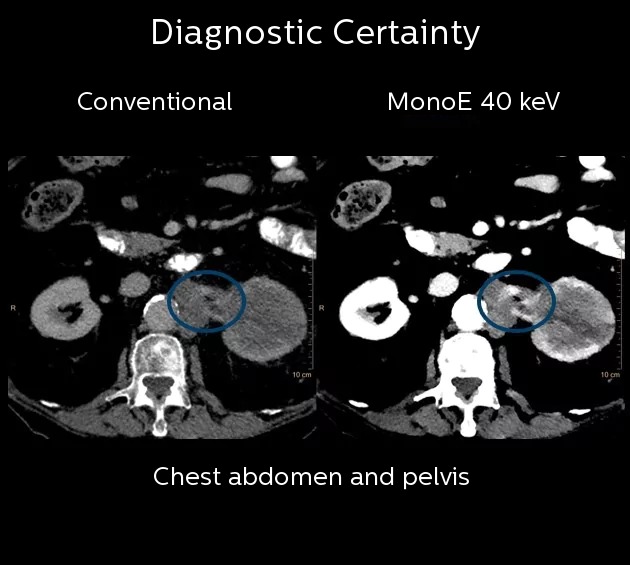 Diagnostic Certainty