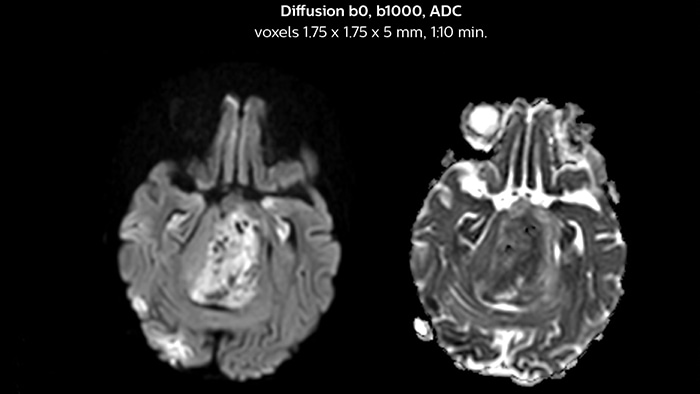 Diffusion image