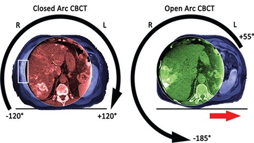 clinical liver coverage