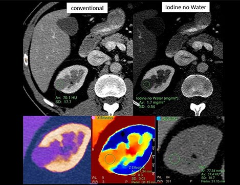 lesion characterization