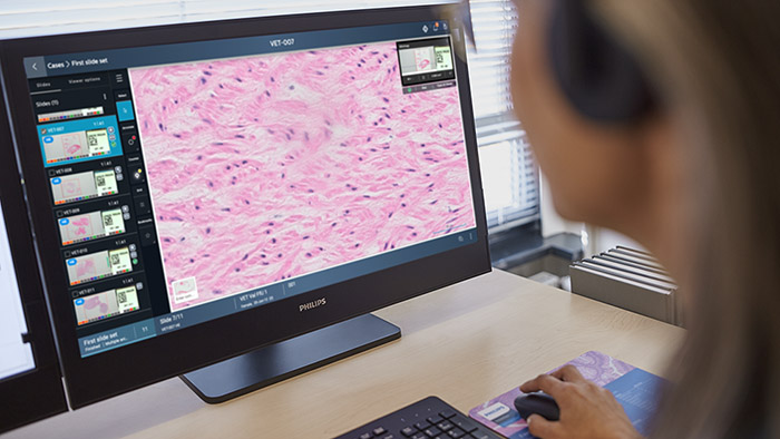 Philips expands digital pathology portfolio with cloud-enabled Philips IntelliSite Pathology Solution on HealthSuite